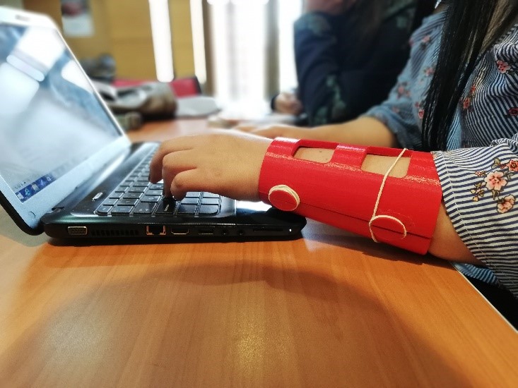 un brazo sobre un teclado de computador, el brazo está inmovilizado con una férula impresa en 3D de color rojo.