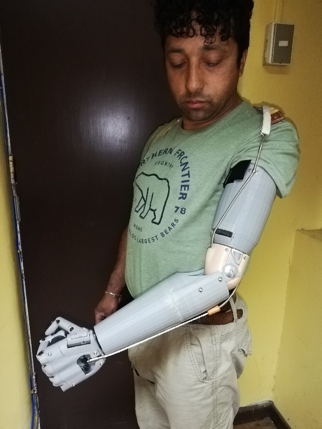 Persona usando una prótesis mecánica del brazo izquierdo impresa en 3D, de color gris.